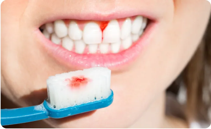 A toothbrush with blood on it from bleeding gums